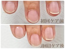 ジェルを使わない美爪育成で自信の持てる健やかなお爪に導きます