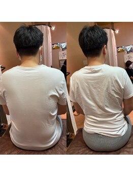 アイビューティーセンター/骨盤矯正＆姿勢矯正1回で完了！