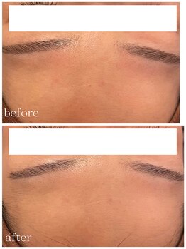 メゾンリュバン 梅田店(Maison Ruban)/ダクトピール｜ツヤ・トーンUP