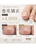 ◇【FOOT】◇痛み軽減サポート◇巻爪補正 ¥4,000
