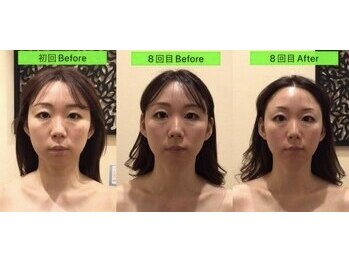 アジール 長岡リバーサイド千秋店(agir)/before/after画像