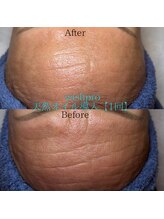 エミナル(EMINALu)/艶や即効性で人気ピーリング