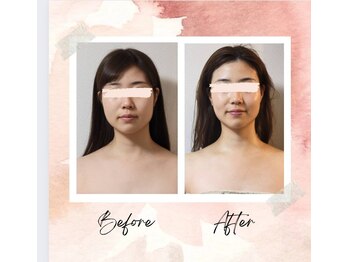 サロンドアクオン(salon de aqon)/立体感を取り戻す