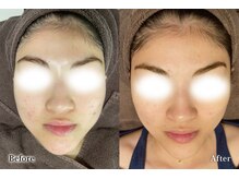 アネル うるま店(anel)/