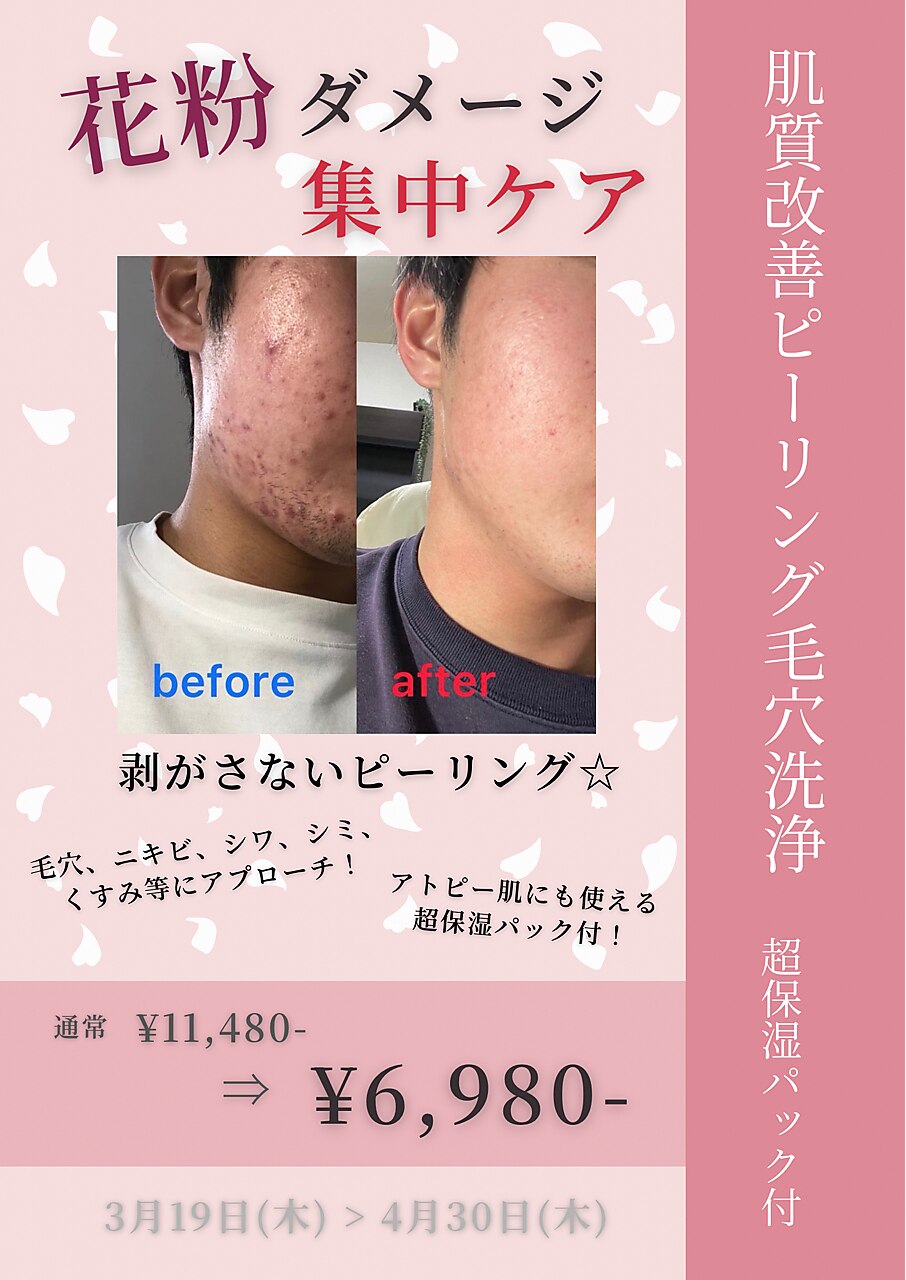 大阪上本町駅で毛穴ケアが人気のエステサロン｜ホットペッパービューティー