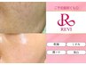 【美白ツヤ肌】ご予定直前OK◎REVI陶肌ハーブピーリング１g+成長因子+パック