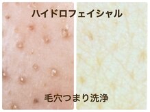 エクラ/毛穴ケア