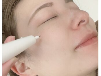ルーミー(LUME.)の写真/《本気のシミケア》肌全体の細かいシミもくすみも改善/ノーファンデ肌を目指せるシミケア