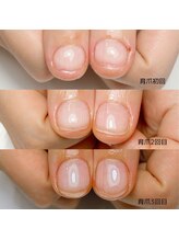 リラネイル(LILA’s nail)