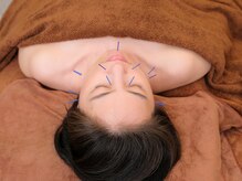 ネージュ鍼灸院(neige鍼灸院)/梅田/南森町/鍼灸◇美容鍼