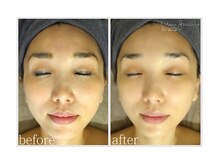 アン グレーヌ 自由が丘(unegraine)/つるん！とむき卵のように…