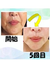 フェリス.ディア(Feliz.Dia)/【ビフォーアフター7】