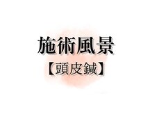 アキュレ(Acure)/頭皮洗浄・頭皮鍼ヘッドスパ