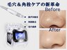 【イチゴ鼻の黒ずみ撃退!】小顔コルギ+毛穴吸引＆洗浄+ヘッド 80分