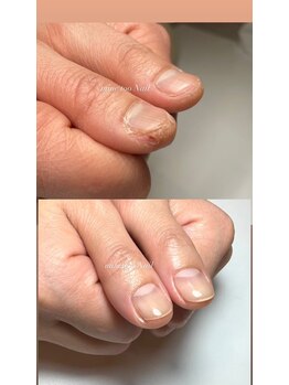 マイントゥ ネイル(mine too nail)/さかむけや爪周りのお肌も!