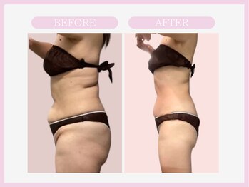 スリムライン 八戸店(The Slim Line)/before→after