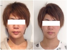 美容整体 ウェリナ 蟹江院/小顔矯正/骨盤矯正/美脚サロン 