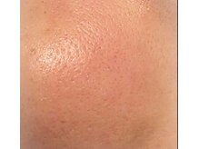 ピーチ ローズ(peach rose)