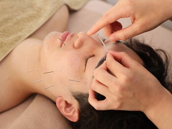 ハリノヒ 本町院/メンズ美容鍼で毛穴改善