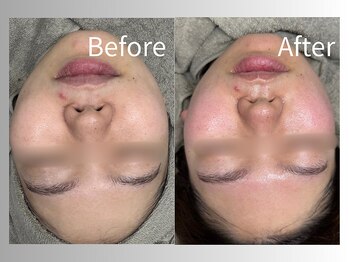 クレーヌ(CREINE)/プラズマ