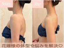 ヴェルセーヌ(VelleSaine)の雰囲気（猫背/巻き肩/横からも美しく整える☆痩身,ブライダルエステ）