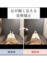 夜の帳/施術効果 Before→After