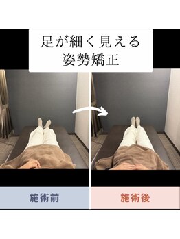 夜の帳/施術効果 Before→After