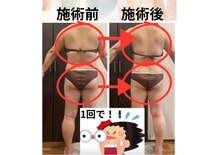 ヨサパーク ハッピーリーズス(YOSA PARK happy risus)