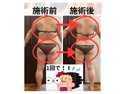 ヨサパーク ハッピーリーズス(YOSA PARK happy risus)の写真