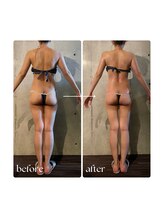 ボーレーヴ 表参道店(beaureve)/施術効果写真（before after）