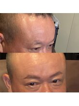 眉毛ハウス 吉祥寺店(眉毛HOUSE)/お客様の施術例(吉祥寺/東京)