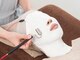 ビューティーマックス(Beauty Max)の写真/本気でお肌を変えたい方へ★【ニキビケア・毛穴洗浄】ハイドラ+エンビロンビタミン導入￥13,200→￥7,700