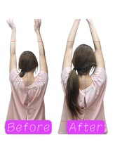 鍼の魔法 恵比寿院/首肩こり　施術回数:1回