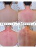 【１ヵ月以内】漢方アロマ×全身リセットリンパ110分16,300→13,920【拝毒!】