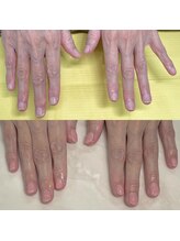 ハッカネイル(HAKKA NAIL)/