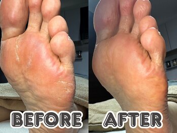 ポドロ ウィズ ニコルル 大阪天満店(PoDoLo with Nicolulu)/【タコ・角質】フットケア大阪