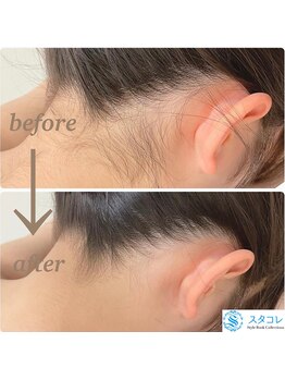 スタコレ スタイルブックコレクションズ 京橋店(Style Book Collections)/うなじ脱毛