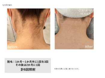 フェレザ 新潟(Felleza)/面倒な自己処理から卒業!