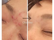 シャルトルズ 西宮北口店/