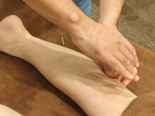 フミ鍼灸院/下肢の鍼施術