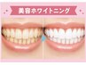 第一印象UP☆輝く白い歯へ☆完全個室で安心◎美容ホワイトニング