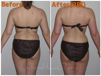 ボディメンテナンスサロン コンフアオーン/痩身メニュー施術のお客様