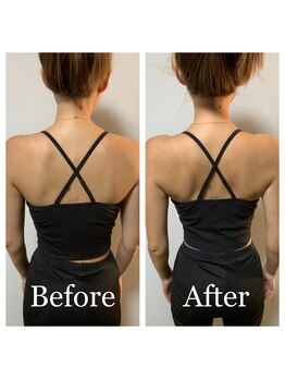 ライズ/お客様のビフォーアフター