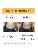 ヴァローレ(valore)/男性 減量成功