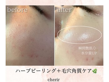 シェリール(cherir)/直後から潤い艶肌◆
