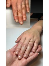 マイントゥ ネイル(mine too nail)/水仕事で傷んだお爪も！