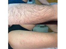 シャイニースキン(Shiny skin)の雰囲気（男女スタッフ在籍しており気軽に通える脱毛サロン）
