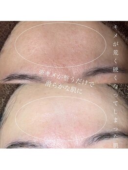 ソワ 吉塚店(soi)/水分バランスが大事!30代女性♪