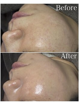 ブラックボックス(BLACK BOX)/30代女性のお客様