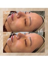 ウリ(uli beauty)/比較写真